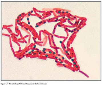 Endospore stain of Bacillus species