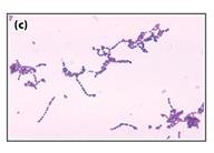 Streptococcus pyogenes under microscope