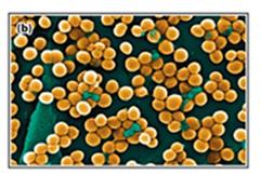 Staphylococcus aureus under microscope