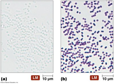 Gram stain: unstained vs. stained cells