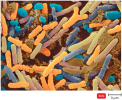 Colorized scanning electron micrograph of diverse bacteria in the human microbiome