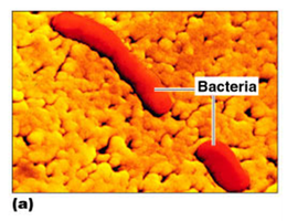 Scanning electron micrograph of rod-shaped bacteria