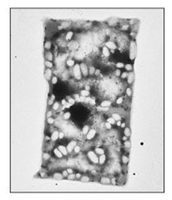 Micrograph of archaea