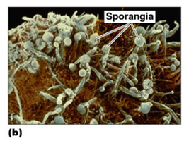 Scanning electron micrograph of fungal sporangia