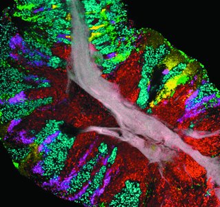 CLASI-FISH image of human tongue microbiome showing multiple bacterial species