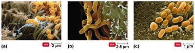 Bacteria on nasal epithelium, stomach lining, and small intestine