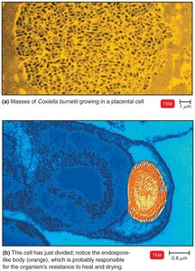 Coxiella burnetii, the Cause of Q Fever