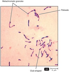 Corynebacterium diphtheriae, the Cause of Diphtheria