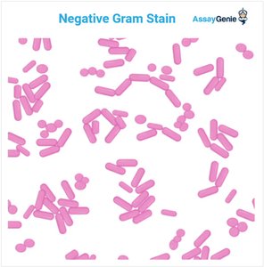 Gram-negative bacilli under Gram stain