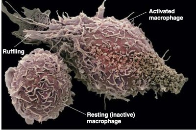 Activated and resting macrophages