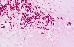 Gram-negative enteric bacilli under microscope