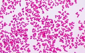 Gram-negative enteric bacilli under microscope