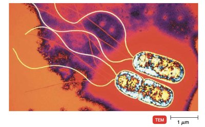 TEM image of Pseudomonas aeruginosa with flagella