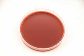 Chocolate agar plate used for culturing Haemophilus influenzae