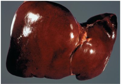Healthy human liver