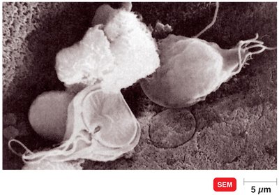 Trophozoite form of Giardia lamblia