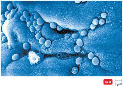 Cryptosporidiosis: oocysts in intestinal mucosa