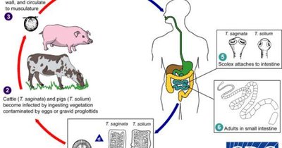 Life cycle of Taenia spp. (beef and pork tapeworms)