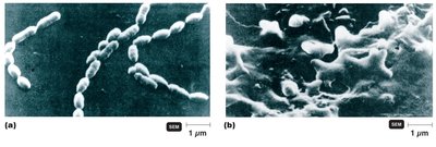 Streptococcus mutans and dextran accumulation in dental caries