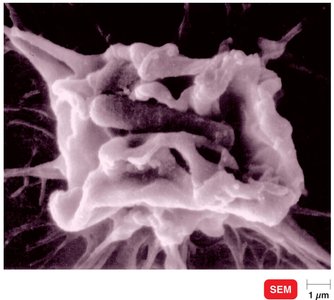 Shigella invasion of intestinal wall