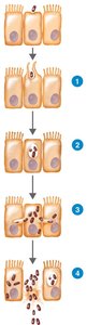 Stages of Shigellosis pathogenesis in the intestinal epithelium