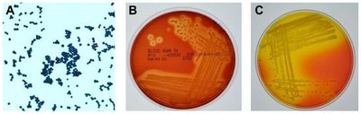 Staphylococcus aureus on blood agar and mannitol salt agar