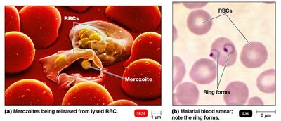 Microscopic diagnosis of malaria: merozoites and ring forms in RBCs