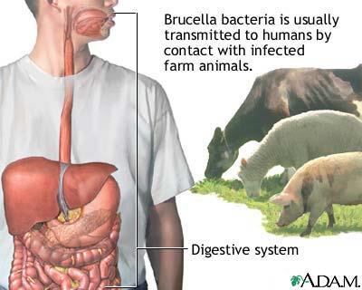 Transmission of Brucella bacteria from farm animals to humans