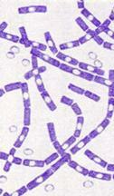 Bacillus anthracis under the microscope