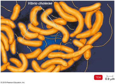TEM of Vibrio cholerae