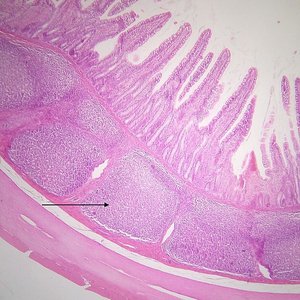 Histological section showing Peyer's patches in the intestinal wall