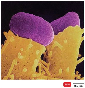SEM of EHEC O157:H7 pedestal formation on host cells