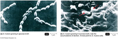 SEM images of Streptococcus mutans and dextran accumulation