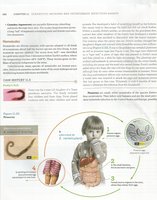 Pinworm infection diagram