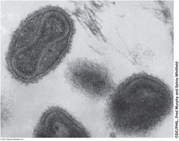 Electron micrograph of poxvirus particles