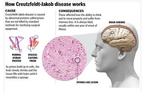How Creutzfeldt-Jakob disease works