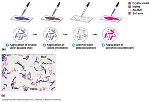 Gram stain procedure and results showing bacterial shapes and colors
