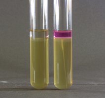 Urease test tubes showing positive (pink) and negative (yellow) results