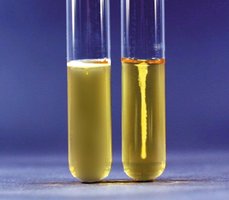Citrate test tubes showing positive (blue) and negative (green) results
