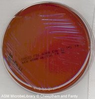 PEA plate with no growth (negative result)