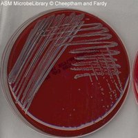 PEA plate with visible bacterial growth (positive result)