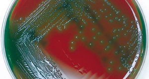 MSA plate with partial yellow zone (partial fermentation)