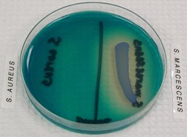 DNAse test plate showing clear zone around positive colony