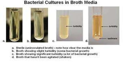 Bacterial cultures in broth media
