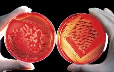 Blood agar in a Petri dish showing beta hemolysis
