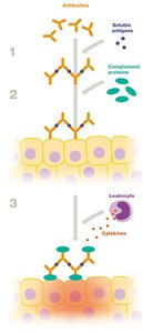 Type III hypersensitivity mechanism