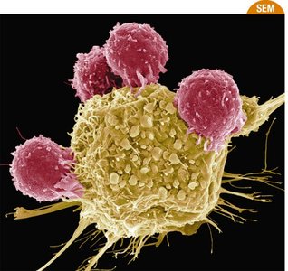Scanning electron micrograph of immune cells attacking a target cell