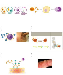Visual summary of immune deficiencies, autoimmunity, and hypersensitivity