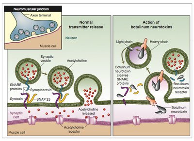 Diagram of botulinum toxin action at the neuromuscular junction