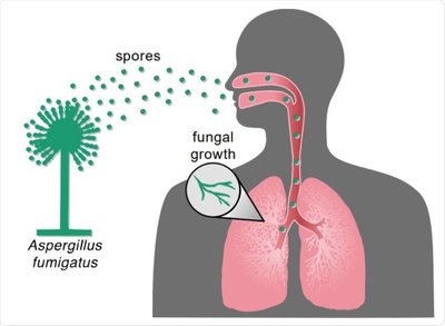 Diagram of Aspergillus fumigatus spores entering the lungs